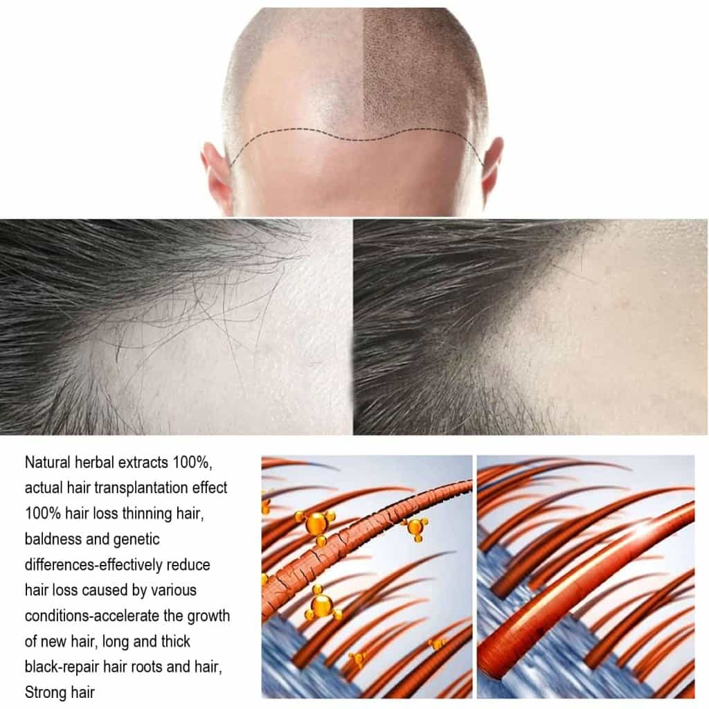 HAIR GROWTH REPAIRING SERUM - BiBa Beauty