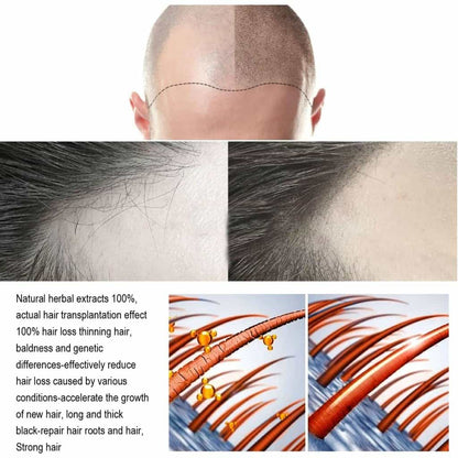 HAIR GROWTH REPAIRING SERUM - BiBa Beauty